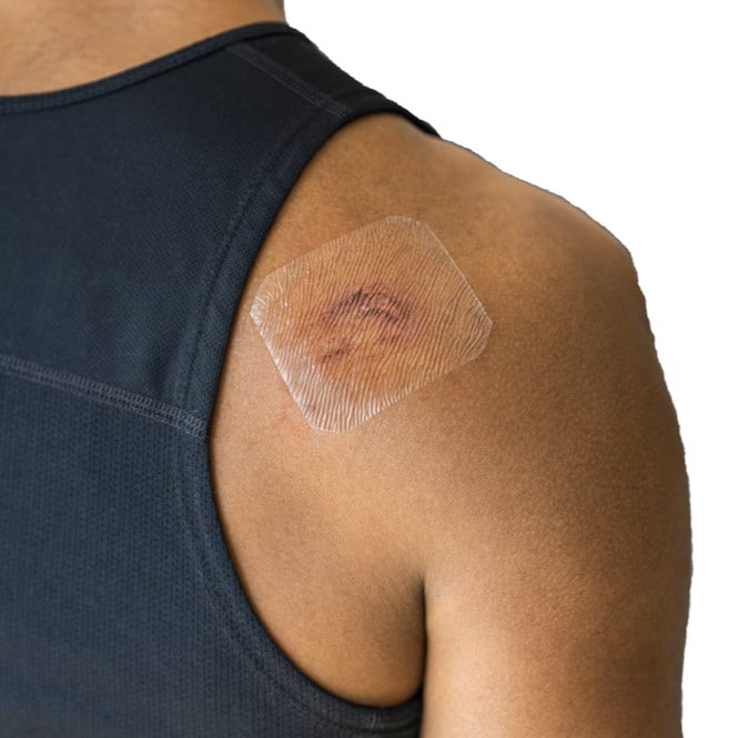 Columns_WoundDressing
